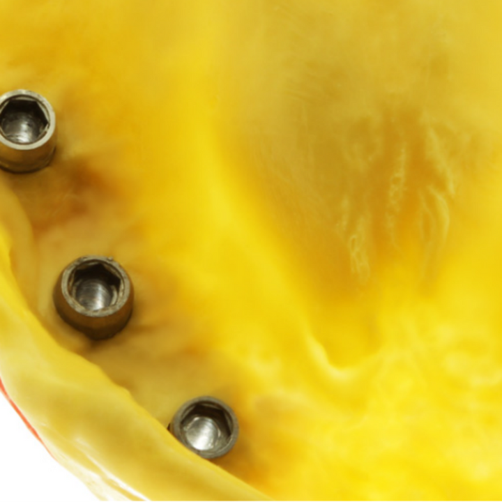 PERFIT Monophase Impression Material | HUGE DENTAL USA