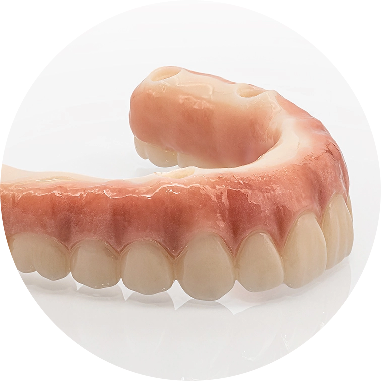 Indirect Restoration